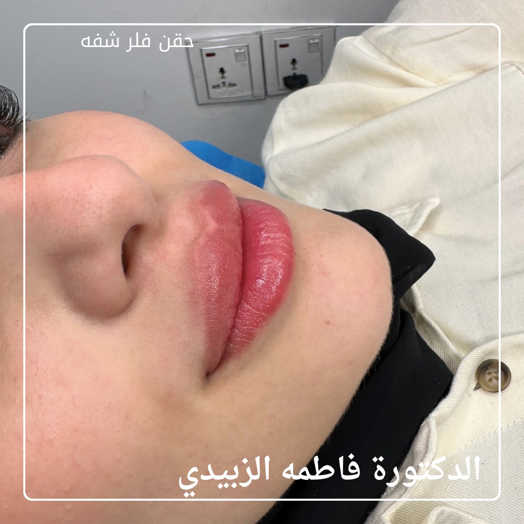 Cosmetic Surgery