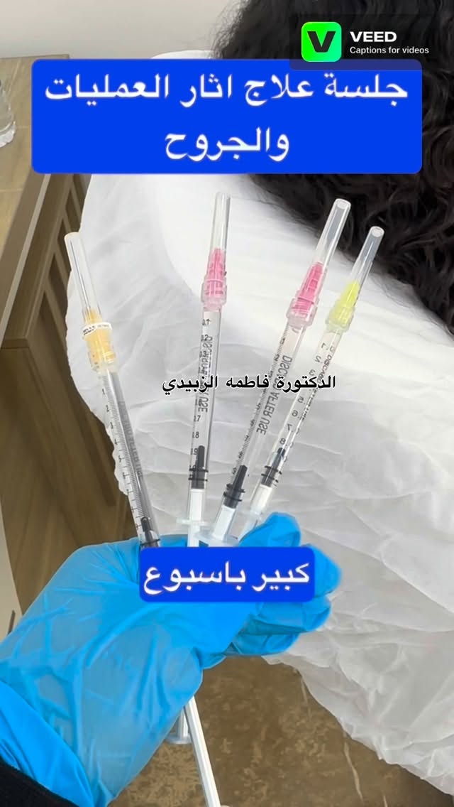Scar removal treatment